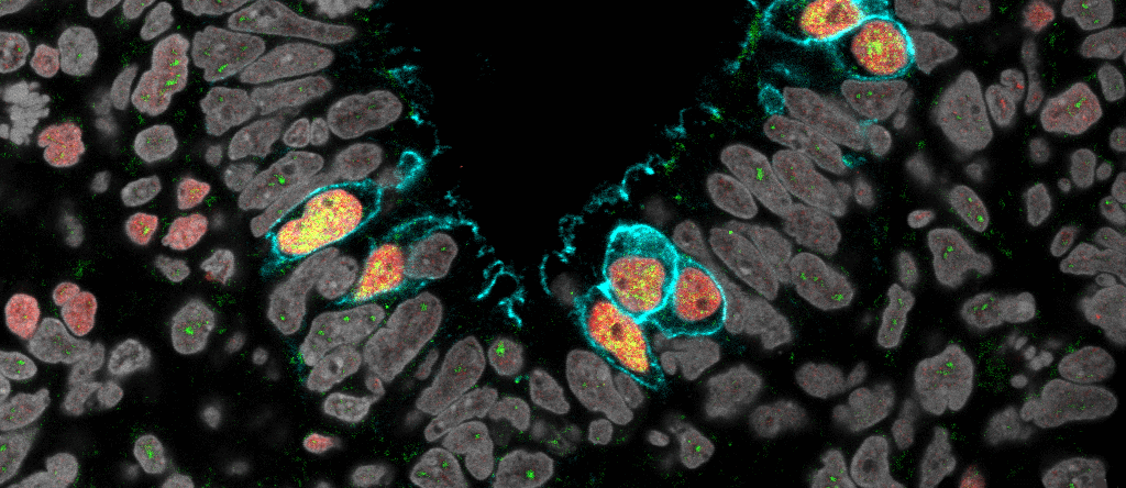 primordial germ cells