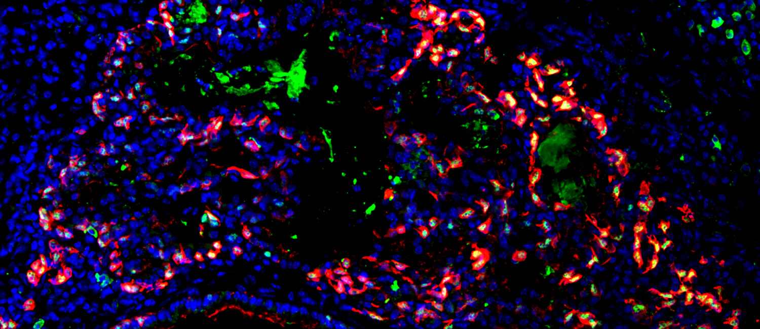 Image of basal cells in a damaged lung one year after injury